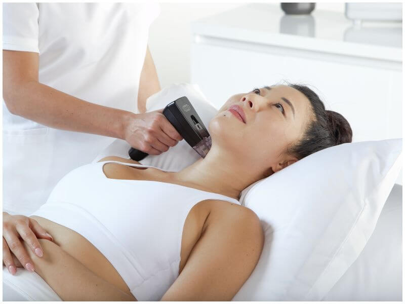 model receiving morpheus8 rf microneedling treatment