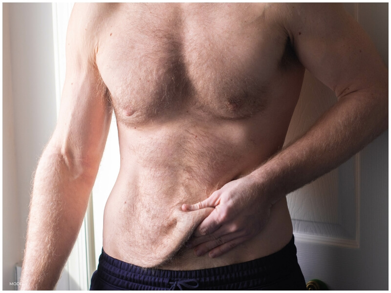 man dealing with excess skin on the abdomen after weight loss indicating the possible need for body plastic surgery