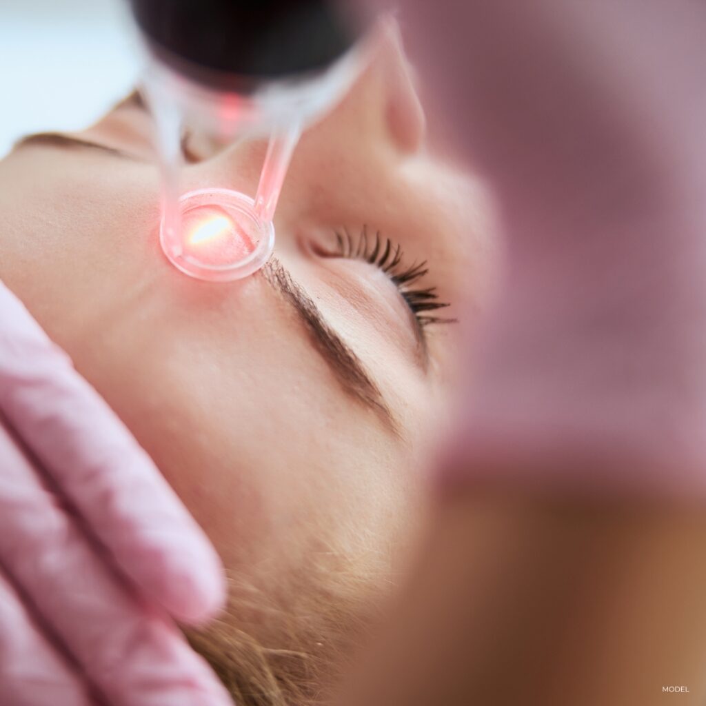 CO2 Laser Skin Resurfacing