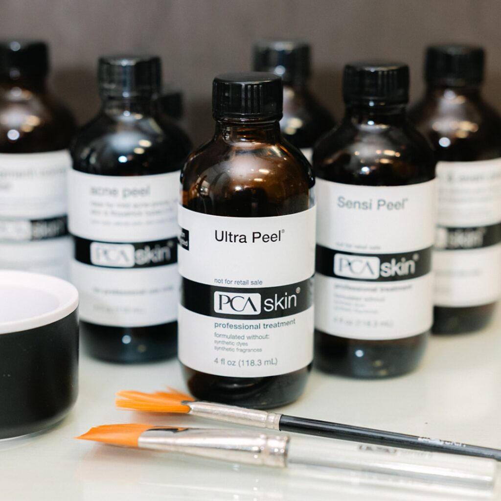 Chemical Peels