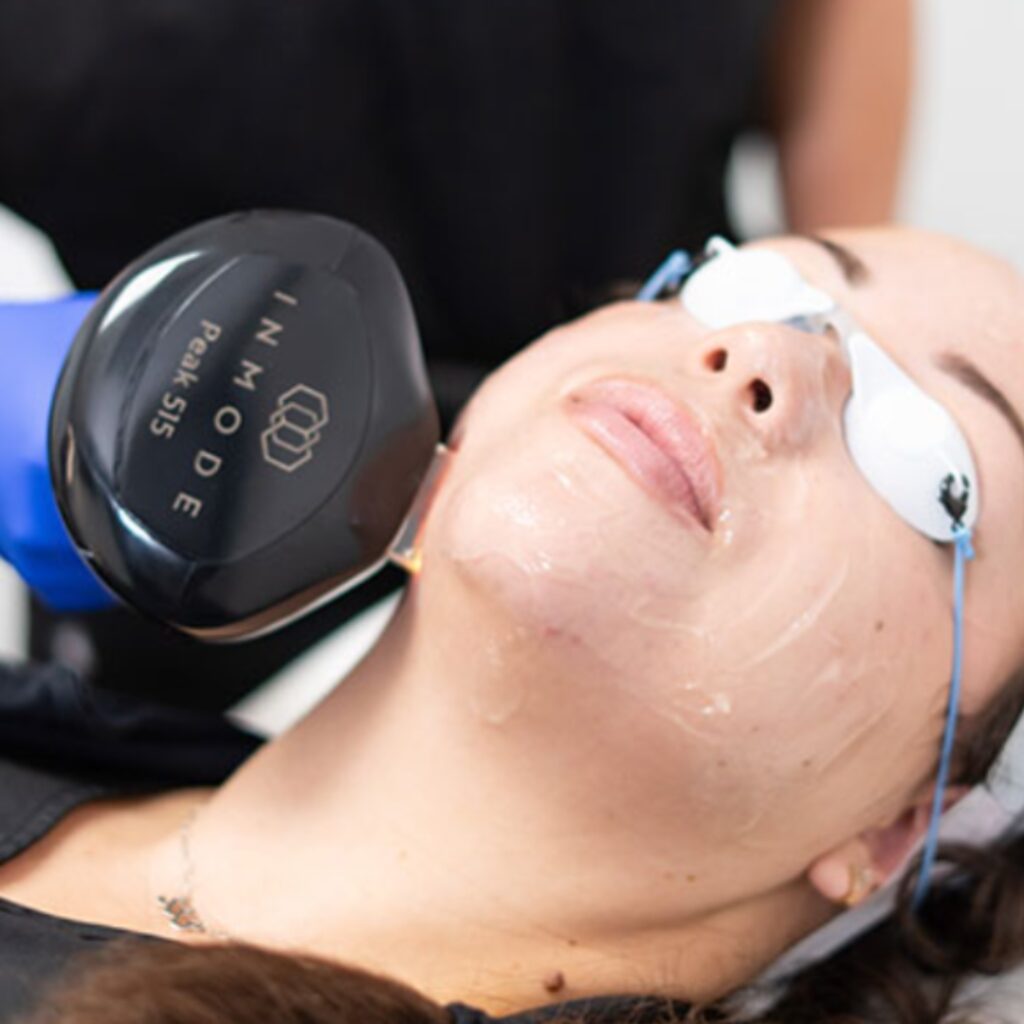 Lumecca IPL