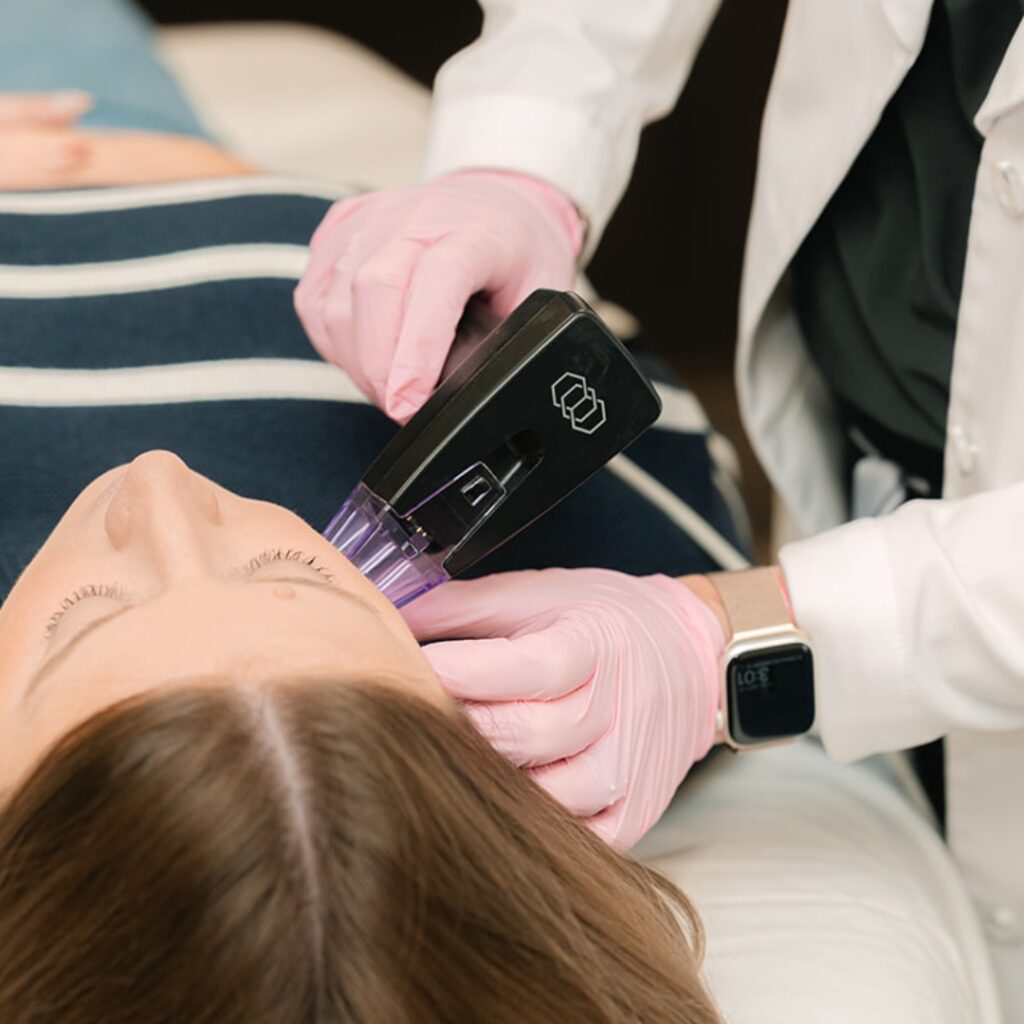 Morpheus8 RF Microneedling